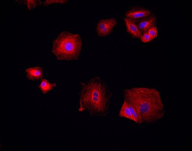 Chicken IgY (H+L) Cross-Adsorbed Secondary Antibody in Immunocytochemistry (ICC/IF)