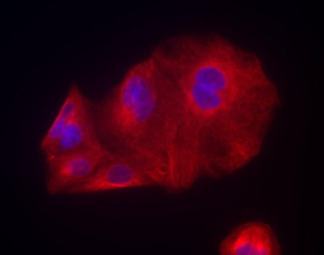 Chicken IgY (H+L) Cross-Adsorbed Secondary Antibody in Immunocytochemistry (ICC/IF)