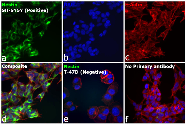 Mouse IgG (H+L) Highly Cross-Adsorbed Secondary Antibody in Immunocytochemistry (ICC/IF)