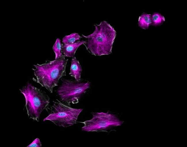 Mouse IgG (H+L) Highly Cross-Adsorbed Secondary Antibody in Immunocytochemistry (ICC/IF)