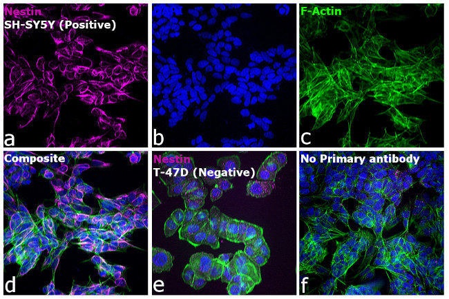 Mouse IgG (H+L) Highly Cross-Adsorbed Secondary Antibody in Immunocytochemistry (ICC/IF)