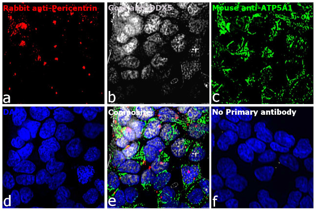 Mouse IgG (H+L) Highly Cross-Adsorbed Secondary Antibody in Immunocytochemistry (ICC/IF)