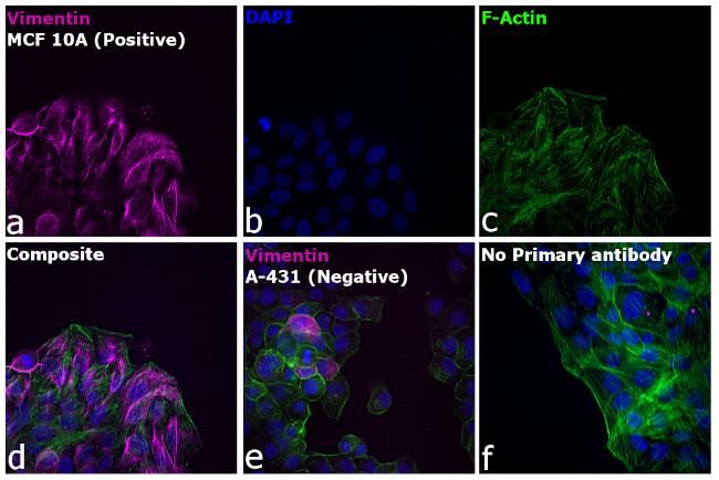 Rabbit IgG (H+L) Highly Cross-Adsorbed Secondary Antibody in Immunocytochemistry (ICC/IF)