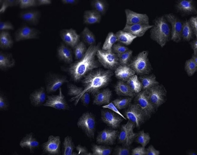 Rabbit IgG (H+L) Highly Cross-Adsorbed Secondary Antibody in Immunocytochemistry (ICC/IF)