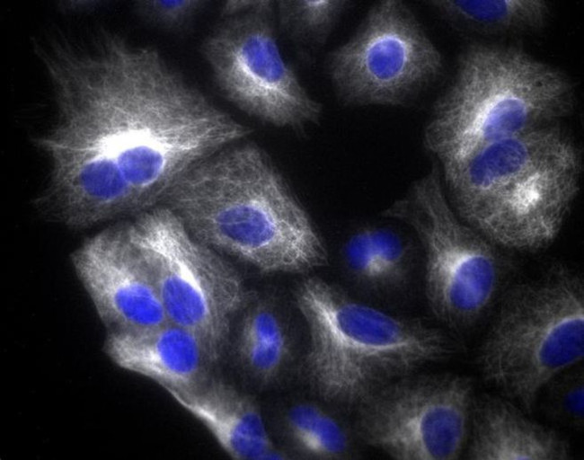 Rabbit IgG (H+L) Highly Cross-Adsorbed Secondary Antibody in Immunocytochemistry (ICC/IF)