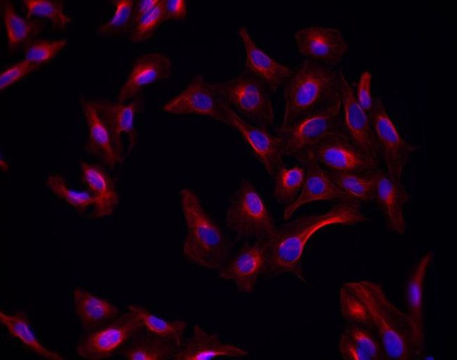 Goat IgG (H+L) Highly Cross-Adsorbed Secondary Antibody in Immunocytochemistry (ICC/IF)