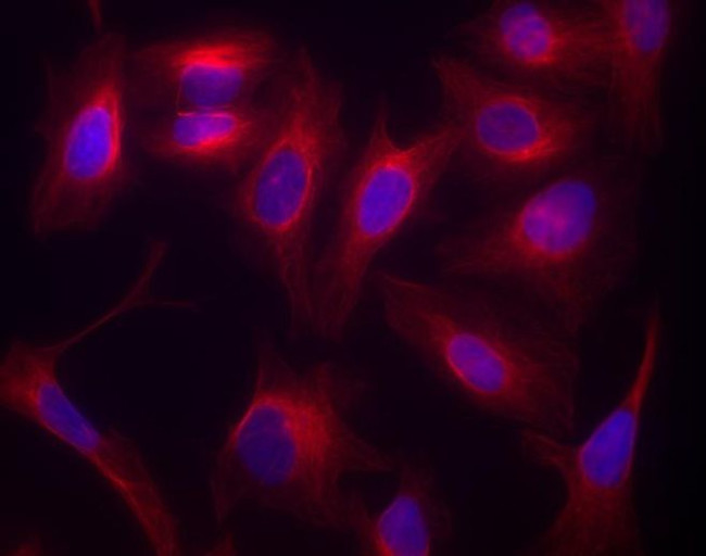 Goat IgG (H+L) Highly Cross-Adsorbed Secondary Antibody in Immunocytochemistry (ICC/IF)