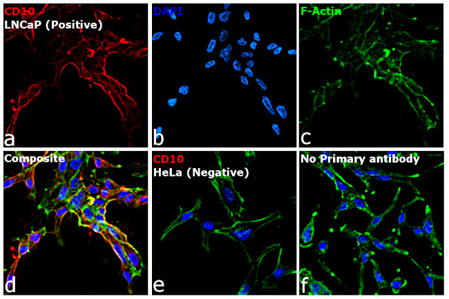 Goat IgG (H+L) Highly Cross-Adsorbed Secondary Antibody in Immunocytochemistry (ICC/IF)