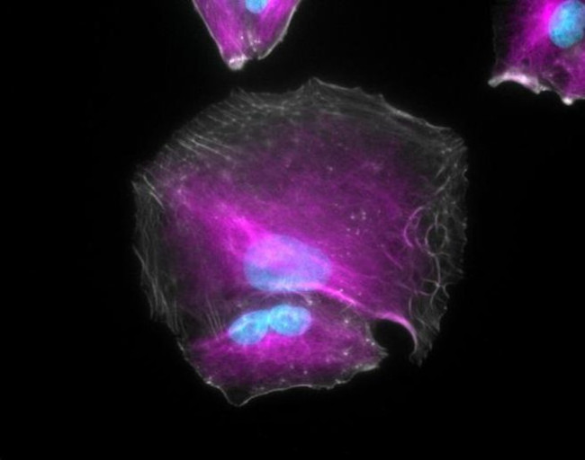 Goat IgG (H+L) Highly Cross-Adsorbed Secondary Antibody in Immunocytochemistry (ICC/IF)