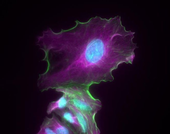 Chicken IgY (H+L) Cross-Adsorbed Secondary Antibody in Immunocytochemistry (ICC/IF)