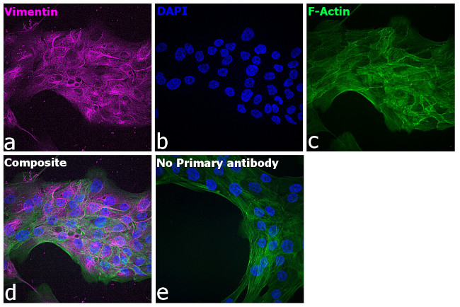 Chicken IgY (H+L) Cross-Adsorbed Secondary Antibody in Immunocytochemistry (ICC/IF)