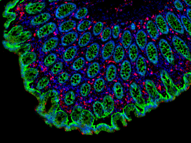 Mouse IgG (H+L) Cross-Adsorbed Secondary Antibody in Immunohistochemistry (Paraffin) (IHC (P))