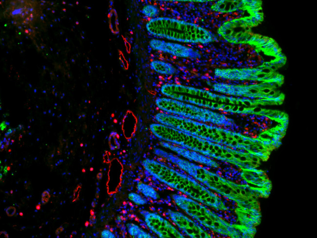 Mouse IgG (H+L) Cross-Adsorbed Secondary Antibody in Immunohistochemistry (Paraffin) (IHC (P))