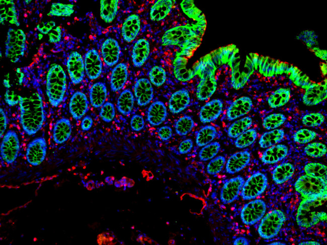 Mouse IgG (H+L) Cross-Adsorbed Secondary Antibody in Immunohistochemistry (Paraffin) (IHC (P))