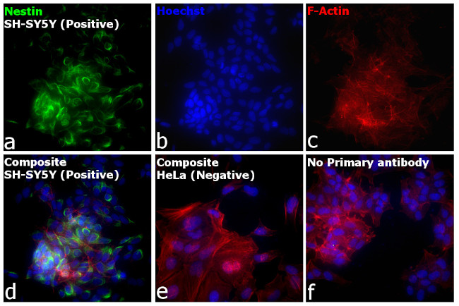 Mouse IgG (H+L) Cross-Adsorbed Secondary Antibody in Immunocytochemistry (ICC/IF)