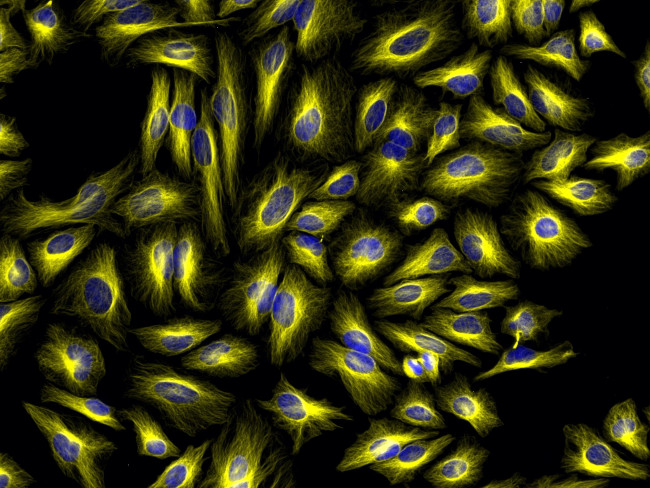 Mouse IgG (H+L) Cross-Adsorbed Secondary Antibody in Immunocytochemistry (ICC/IF)