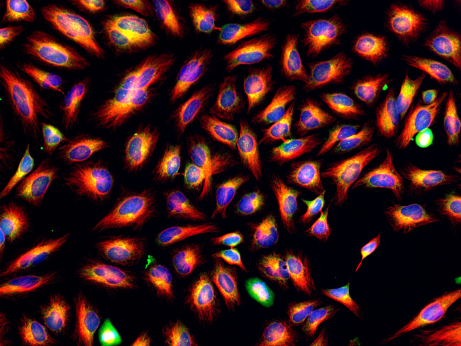 Mouse IgG (H+L) Cross-Adsorbed Secondary Antibody in Immunocytochemistry (ICC/IF)