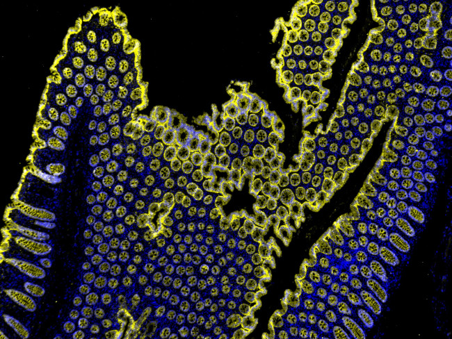 Mouse IgG (H+L) Cross-Adsorbed Secondary Antibody in Immunohistochemistry (Paraffin) (IHC (P))