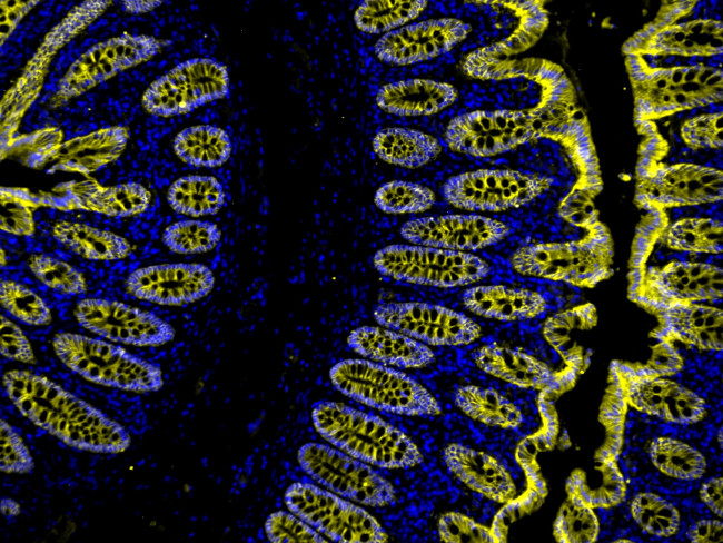 Mouse IgG (H+L) Cross-Adsorbed Secondary Antibody in Immunohistochemistry (Paraffin) (IHC (P))