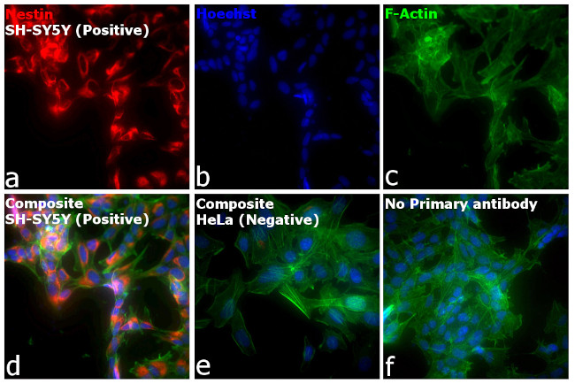 Mouse IgG (H+L) Cross-Adsorbed Secondary Antibody in Immunocytochemistry (ICC/IF)