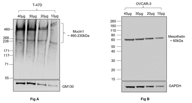 Human IgG (H+L) Secondary Antibody in Western Blot (WB)