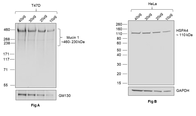 Human IgG (H+L) Secondary Antibody in Western Blot (WB)