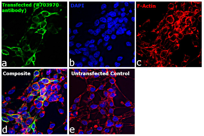 Human IgG (H+L) Secondary Antibody in Immunocytochemistry (ICC/IF)