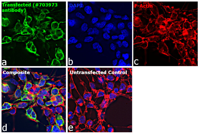 Human IgG (H+L) Secondary Antibody in Immunocytochemistry (ICC/IF)