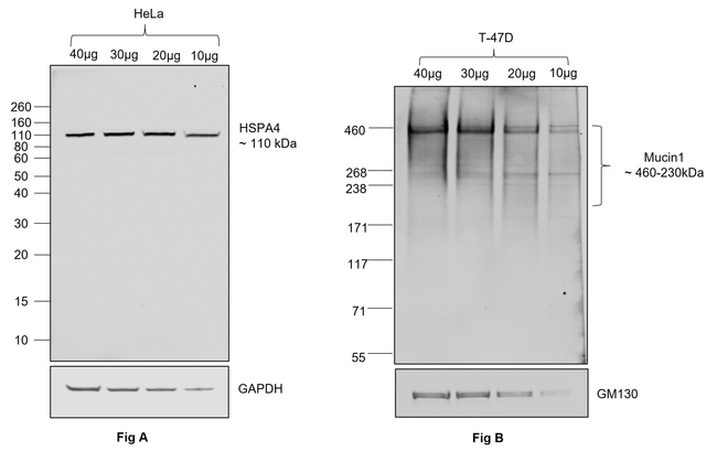 Human IgG (Light chain) Secondary Antibody in Western Blot (WB)