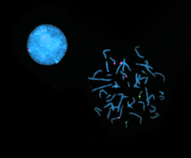 Texas Red Antibody in Immunocytochemistry (ICC/IF)