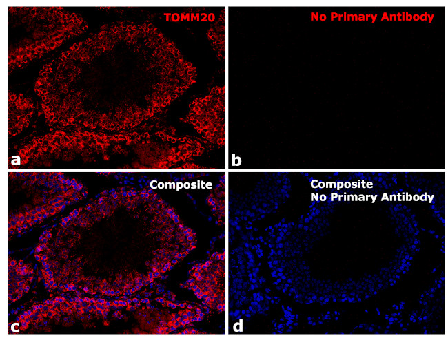 Rabbit IgG Fc Secondary Antibody in Immunohistochemistry (Paraffin) (IHC (P))