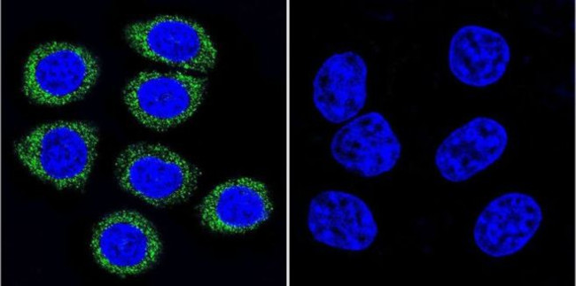 ARF1/ARF3/ARF5/ARF6 Antibody in Immunocytochemistry (ICC/IF)