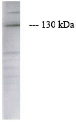 JAK2 Antibody in Western Blot (WB)