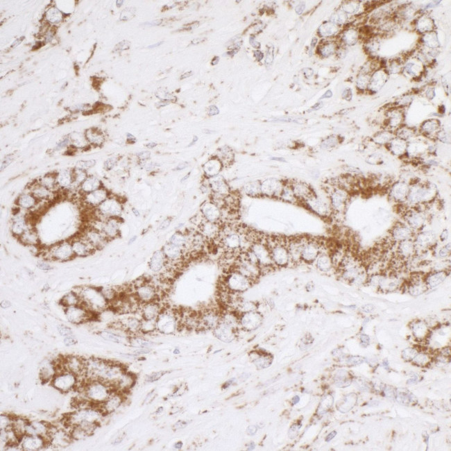 ATP5A1 Antibody in Immunohistochemistry (IHC)