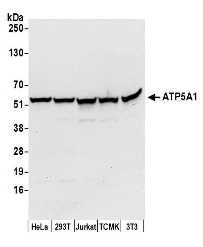 ATP5A1 Antibody in Western Blot (WB)