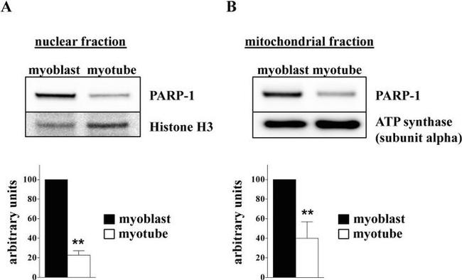 ATP5A1 Antibody in Western Blot (WB)