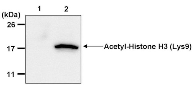 H3K9ac Antibody in Immunoprecipitation (IP)