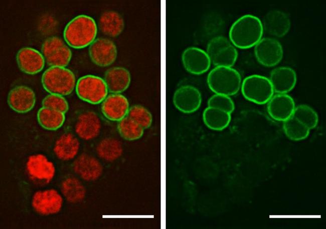 Actin Antibody in Immunocytochemistry (ICC/IF)