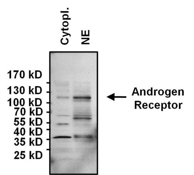 Androgen Receptor Antibody in Western Blot (WB)