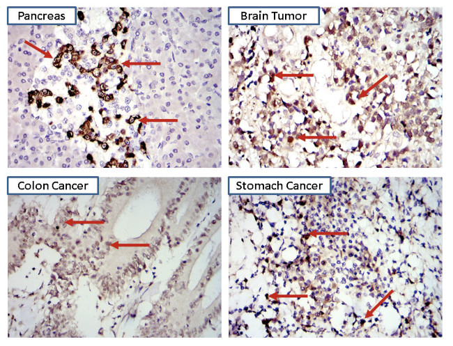 STAT3 Antibody in Immunohistochemistry (IHC)