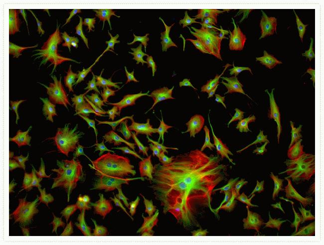 Mouse IgG (H+L) Cross-Adsorbed Secondary Antibody in Immunocytochemistry (ICC/IF)