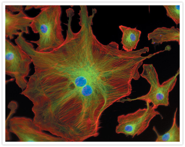 Mouse IgG (H+L) Cross-Adsorbed Secondary Antibody in Immunocytochemistry (ICC/IF)