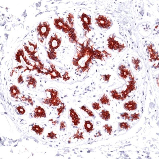 Bax Antibody in Immunohistochemistry (Paraffin) (IHC (P))