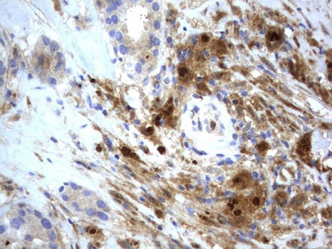 BID Antibody in Immunohistochemistry (Paraffin) (IHC (P))