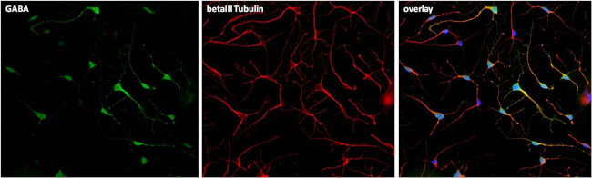 beta Tubulin Antibody in Immunocytochemistry (ICC/IF)