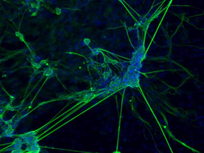 beta-3 Tubulin Antibody in Immunocytochemistry (ICC/IF)