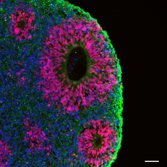 beta-3 Tubulin Antibody in Immunohistochemistry (Frozen) (IHC (F))