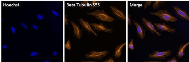 beta Tubulin Antibody in Immunocytochemistry (ICC/IF)