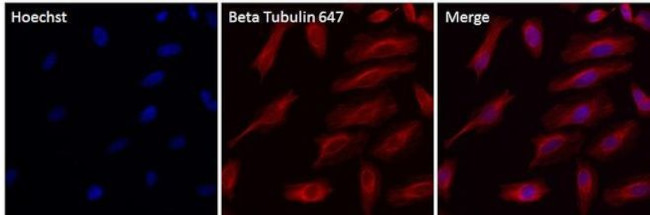 beta Tubulin Antibody in Immunocytochemistry (ICC/IF)