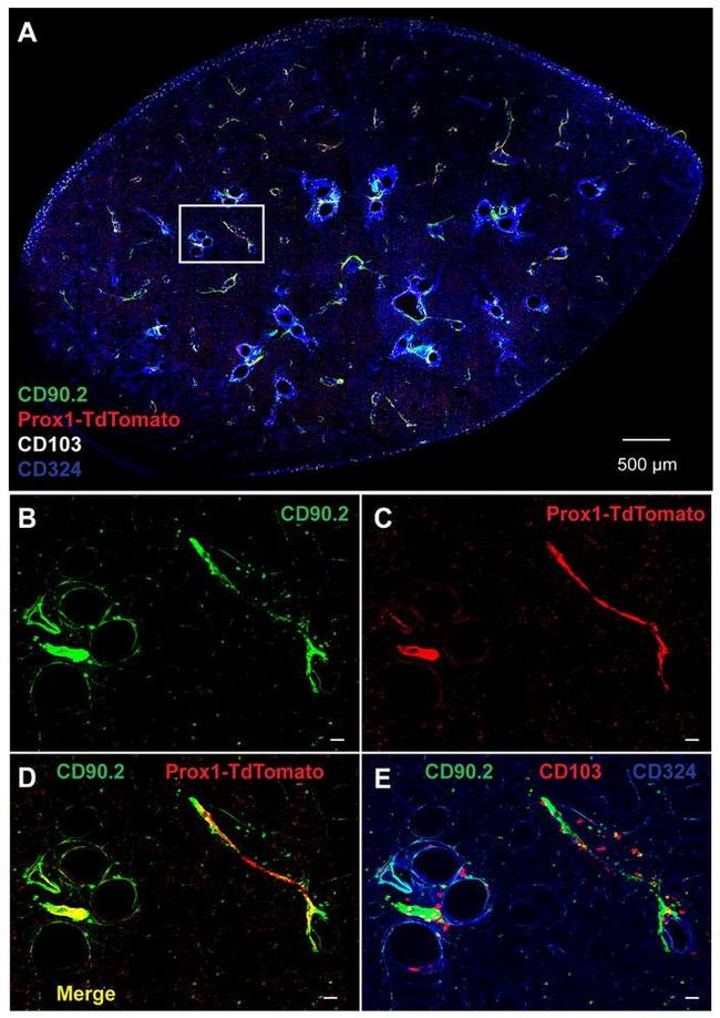 CD103 (Integrin alpha E) Antibody in Immunohistochemistry (IHC)